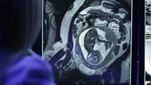 Clinician viewing prenatal MRI image