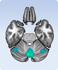 Axial brain schematic highlighting cerebellar regions