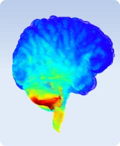 Colorized brain scan showing neural activity