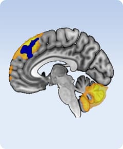 Sagittal brain diagram with highlighted regions
