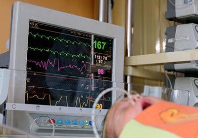 Hospital patient connected to medical monitor.