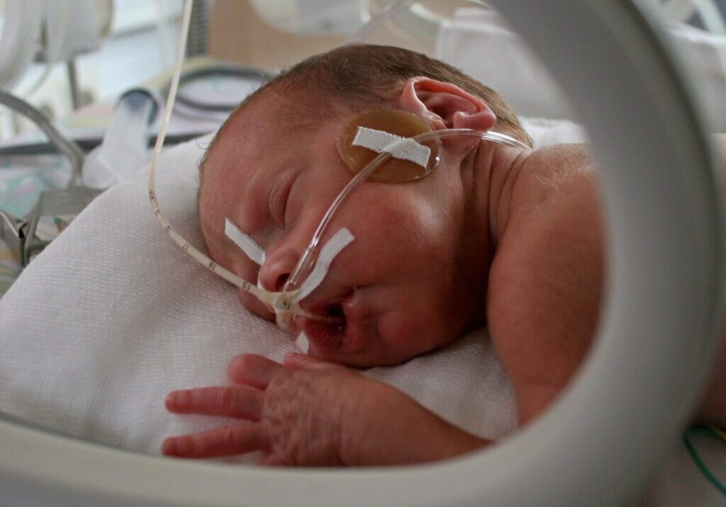 Neonate In Incubator