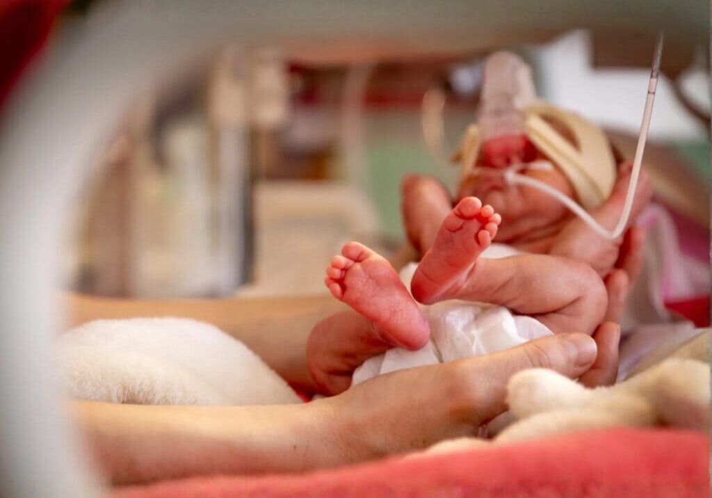 Premature baby in an incubator receiving care.