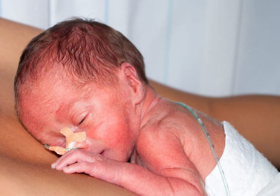 Skin-to-skin contact with a newborn